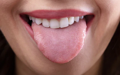 Proper Tongue Hygiene